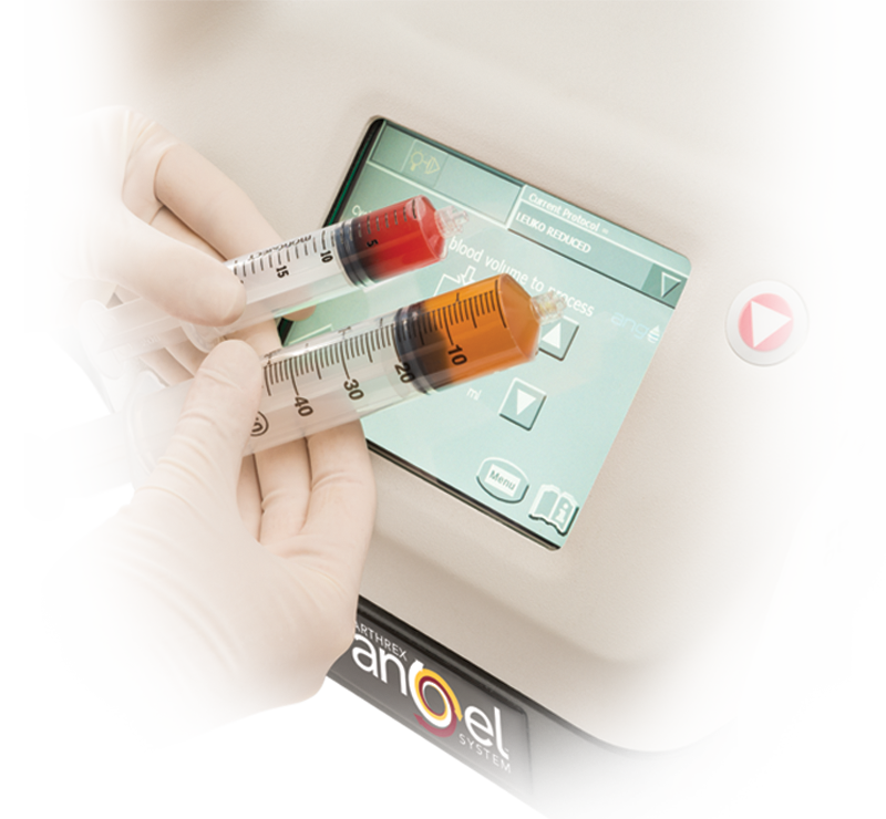 PRP / PRF Orthobiologics